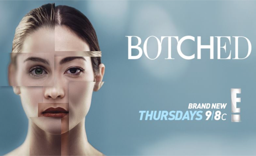 Botched Recap 8/3/17: Season 4 Episode 8 “Sticky Nipples and Paparazzi Nightmares”