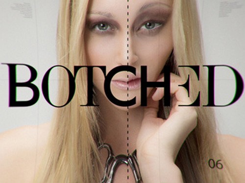 Botched Recap 10/26/14: Season 1 Episode 9 Reunion Part 1 “Show & Tell”