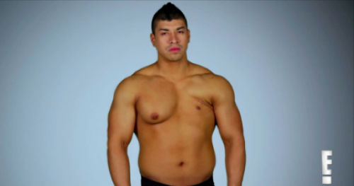 Botched Recap 6/21/15: Season 2 Episode 10 “The Pec Whisperer”