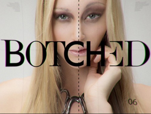 Botched Recap 7/13/14: Season 1 Episode 4 “Making of a Belieber”