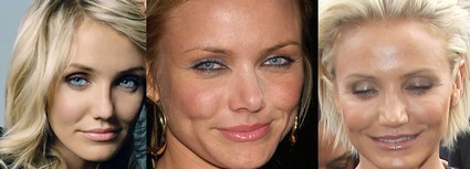 Cameron Diaz Destroyed By Cosmetic Surgery Gone Wild  (Photo)