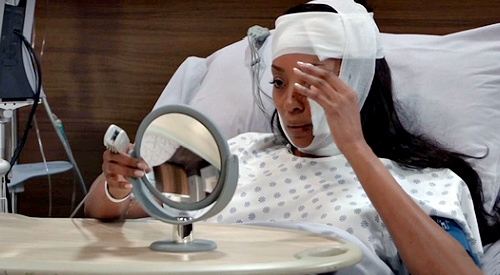 General Hospital Spoilers: Sidwell’s Expert Surgeon Fixes Jordan’s Scars, But There’s a Catch?