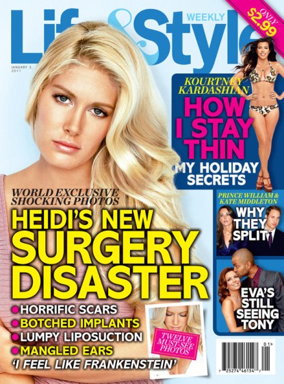 Heidi Montag Reveals Her Regrets and Plastic Surgery Scars