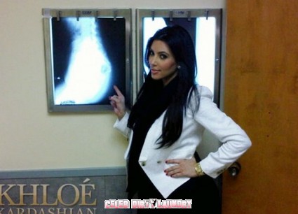 Kim Kardashian Gets An X-Ray To Prove Her Bum Is Real – Photo