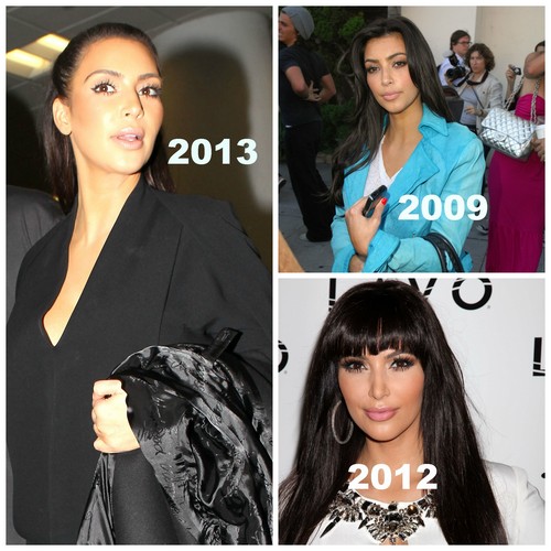 Kim Kardashian Plastic Surgery Obsession: Totally Changed Her Face And Body In Four Years (PHOTO)