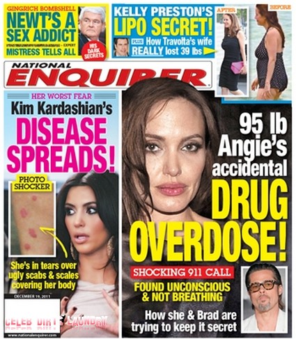 Kim Kardashian’s Disease Spreads, Her Biggest Fear!