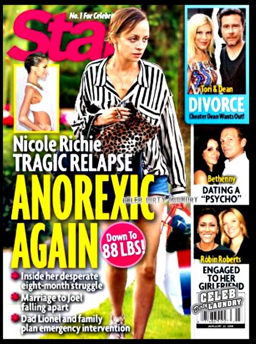 Nicole Richie’s Drastic Weight Loss And Spiral Down Into Anorexia (PHOTO)