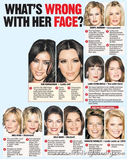 Celebs’ Plastic Surgery Has Passed The Critical Point – They Now Look Freaky