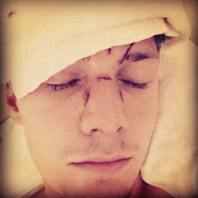 Lindsay Lohan Not Responsible For Barron Hilton’s Beating Claims Assailant Ray Lemoine – Sounds Fishy