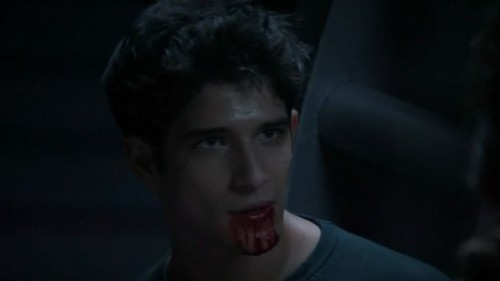 Teen Wolf RECAP 6/17/13: Season 3 Episode 3 “Fireflies”