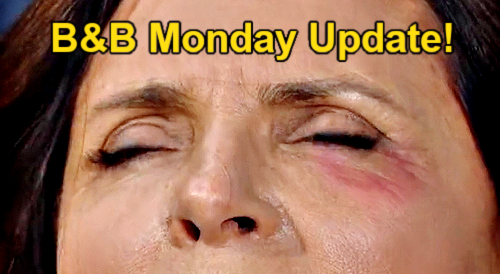 The Bold and the Beautiful Update: Monday, November 6 – Steffy Gives Sheila a Black Eye – Eric’s Amazing Gift