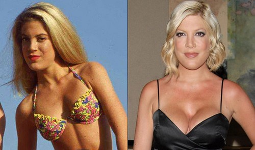 Tori Spelling So Poor She Can’t Afford Hubby’s Vasectomy But She Buys Lots Of Plastic Surgery! (PHOTOS – VIDEO)