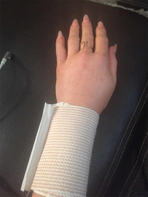 Brandi Glanville Injures Herself In Brutal Hoverboard Accident: Documents Wounds On Twitter!