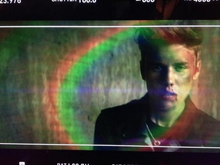 A Bruised Justin Bieber Beaten Up (Photo)
