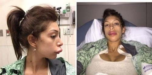 Farrah Abraham Plastic Surgery Nightmare: Begs To Be On E!’s Reality TV Show ‘Botched’ As Her Star Power Wanes!