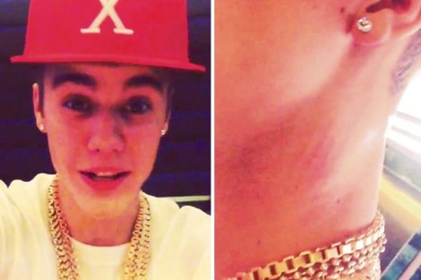 Justin Bieber’s Manager Demands He Go To Rehab After Singer Falls Down The Stairs (VIDEO)