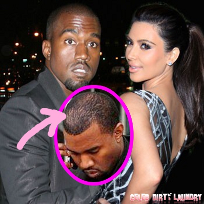 Kim Kardashian Is Making Kanye West Go Bald (Photo)