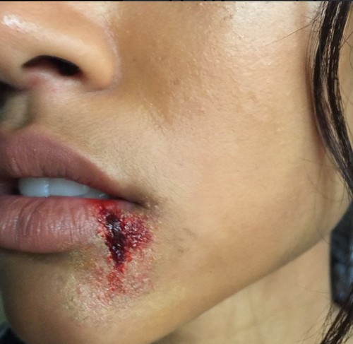Karrueche Tran Implies Chris Brown Responsible for Bloody Lip After Tyson Beckford Instagram Threats?