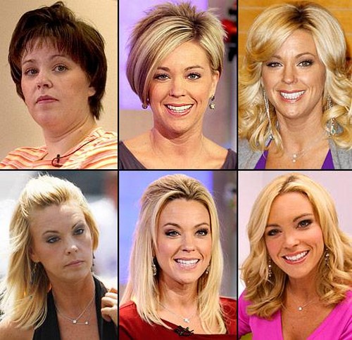 Kate Gosselin Sends Special-Needs Son Collin Away To ‘Get Help’ – Shuns Problem Child?