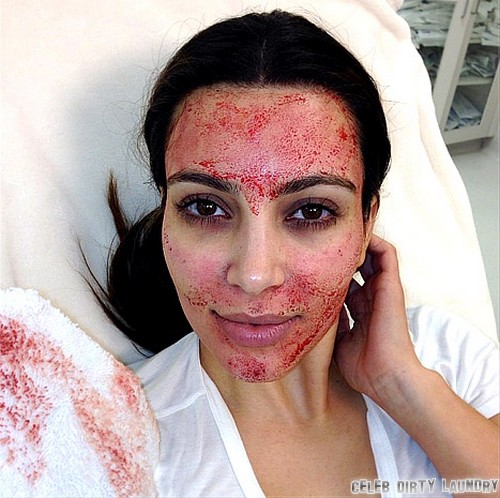 Kim Kardashian Gets Bloody Facial On ‘Kourtney & Kim Take Miami’ (Photo)