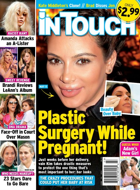 Kim Kardashian’s Plastic Surgery While Pregnant (Photo)