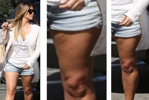 Kim Kardashian in Short Shorts Shows Off Cellulite, Stretch Marks, and Flabby Legs on Lunch Date (PHOTOS)