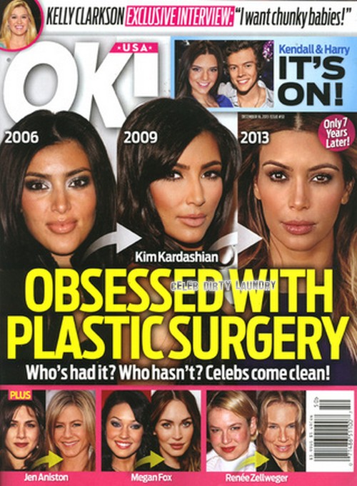 Kim Kardashian’s Plastic Surgery Includes: Breast and Butt Implants, Nose Job, Botox and Liposuction According to Doctors (PHOTOS VIDEO)