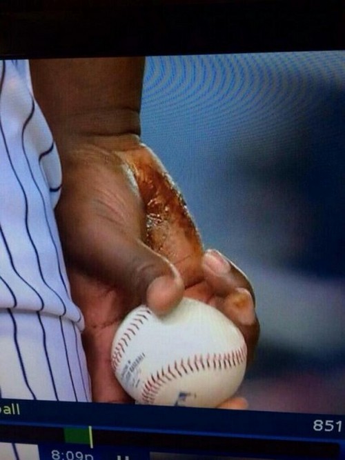 Michael Pineda Ejected For Cheating Against Red Sox: Yankee’s Pitcher Wears Pine Tar!