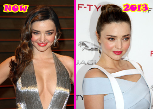 Miranda Kerr’s New Boob Job: Top Docs Claim She’s Definitely Had Plastic Surgery! (PHOTOS)