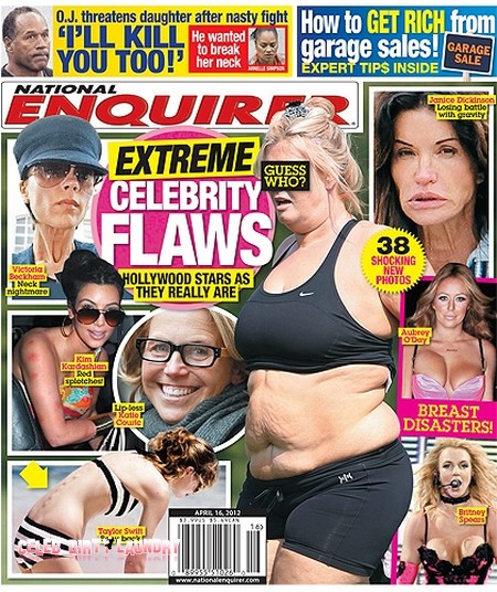 Extreme Celebrity Flaws – Hollywood Stars As They Really Are! (Photo)