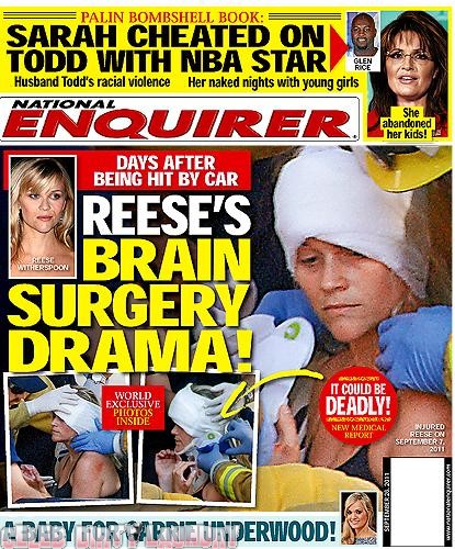 National Enquirer: Reese Witherspoon’s Brain Surgery Drama – Photo