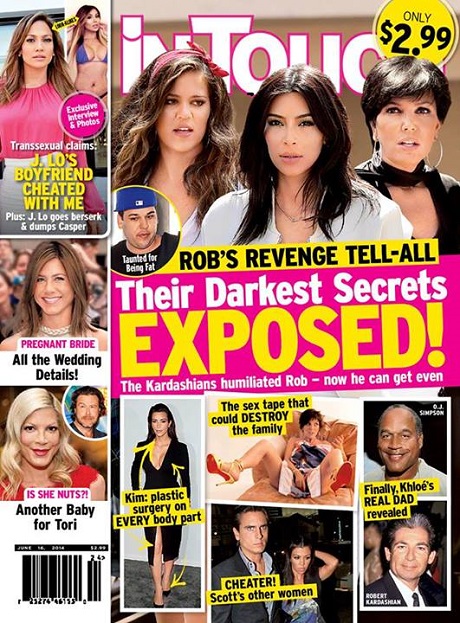Rob Kardashian’s Revenge Tell-All To Expose Countless Family Secrets – Including Kim Kardashian’s Drastic Plastic Surgeries! (PHOTO)
