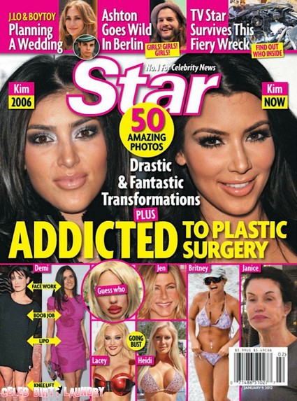 Celebs Addicted To Plastic Surgery – Drastic & Fantastic Transformations (Photos)