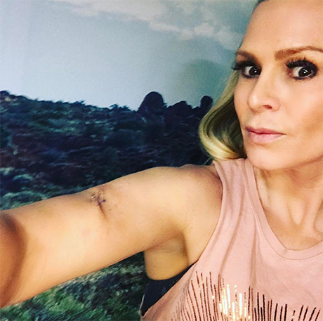 Tamra Judge Reveals Skin Cancer Fears And Mystery Mole: Uses Health Scare For ‘Real Housewives of Orange County’ PR Gains?
